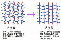 筋膜リリースとは - 堺市西区で姿勢を改善させるなら｜整骨院 匠